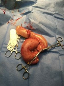 Pyometra spay