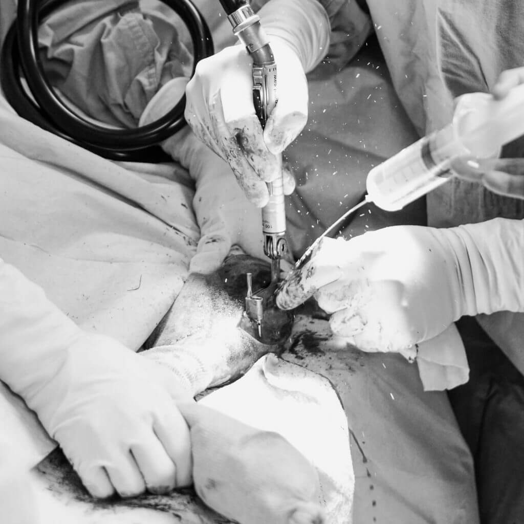 TTA tibial tuberosity advancement